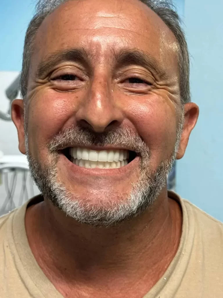 pacientes dr jenival junior dentista de implante prótese em Itabuna