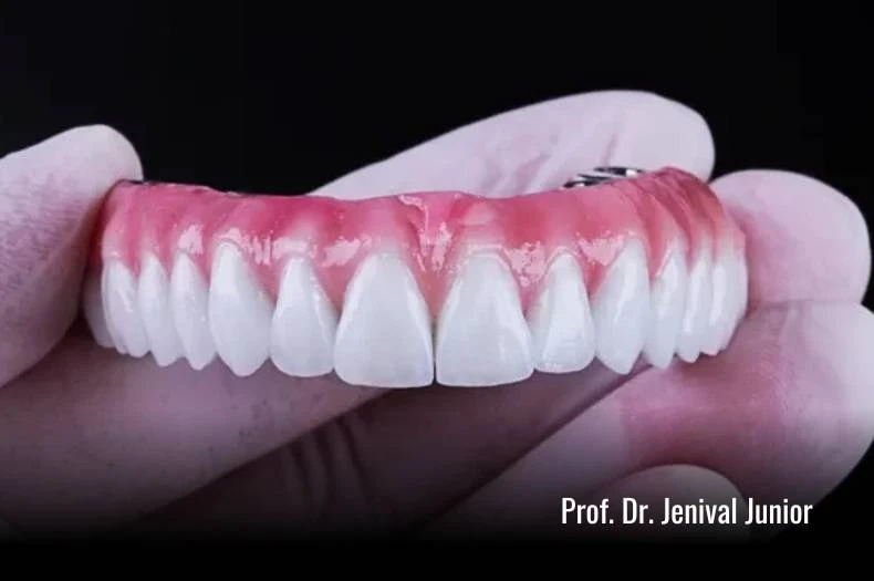 prótese dentária em itabuna ba dentista jenival junior