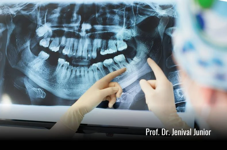 radiografia odontologica em itabuna ba dentista jenival junior